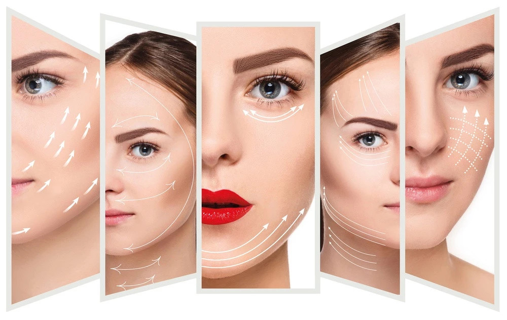 Absorbable подъем потока глаза Pdo Cog 3D продевая нитку для того чтобы поднять сторону l тупую