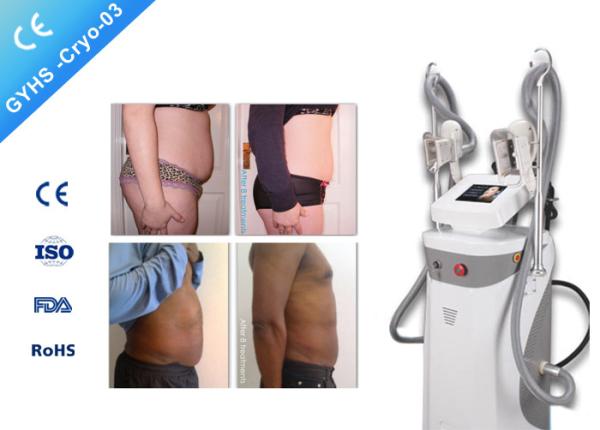Ultra Cryolipolysis Body Slimming Machine , Multipolar RF Cavitation Slimming Equipment