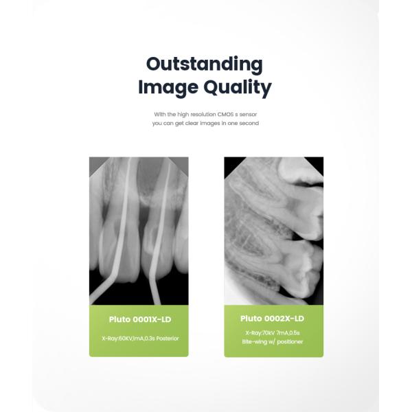 Датчик РВГ рентгеновского снимка КМОС ИнтраОрал цифров зубоврачебный для удара клиники БФ анти-