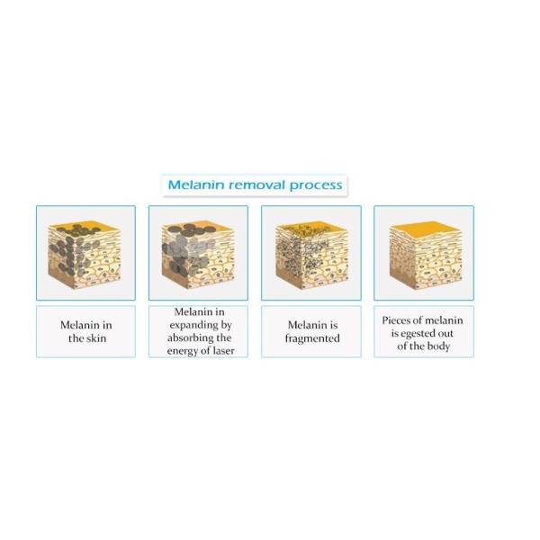 Q Switch Nd Yag Laser Tattoo Removal Equipment / Alexandrite Laser Tattoo Remover Machine