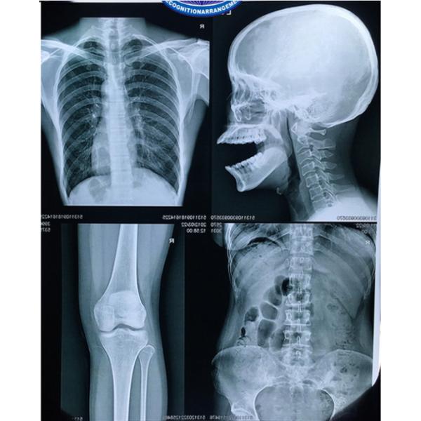 210 Microns Blue X Ray Film Medical Inkjet Printing Film For Hospital