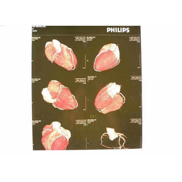 Фильм медицинский кс Рэй ЛЮБИМЦА Хосипитал бумажное делает белизну водостойким фильма 8 КТ дюйма ×10