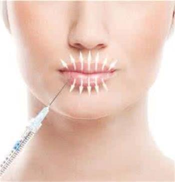 1ml 2ml  Top Pure Cross Link Super Hyaluronic Acid Filler for face lift