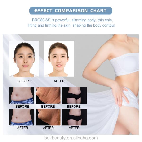 Multifunctional Vacuum Cavitation System With 4 Cryo Handles RF Fat Burning Machine