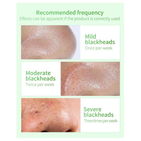 Удаление черных голов Серум для лица Природный органический антивозрастный ремонт Серум для ухода за кожей