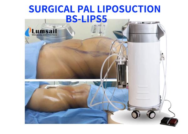 PAL Ultrasonic Surgical Liposuction Machine Slimming Beauty Equipment With Cannula Set