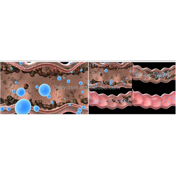 Машина 380В оборудования гидротерапии толстой кишки вытрезвителя реклама