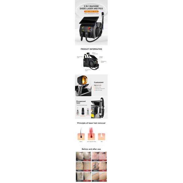 New Design 2 in 1 Picosecond Laser 808 755 1064nm Diode Laser Hair Removal Equipment for Salon
