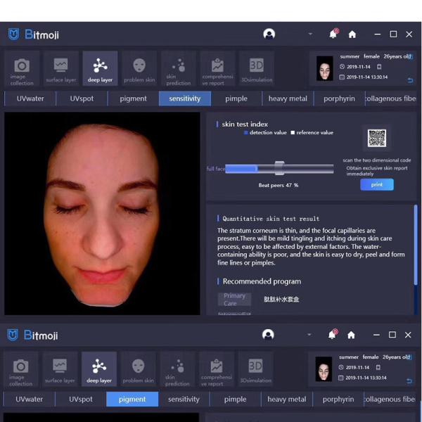 Дружественный анализатор кожи стороны компьютера Usb