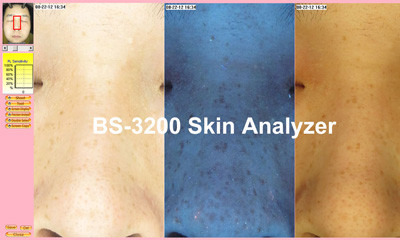 3: 4 Preview system, and Front slant window Facial Skin Analyzer Magic Mirror BS-3200