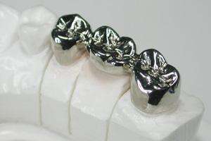 Cobalt Chromium Alloy Dental Crown with CAD/CAM Milling for High Tensile Strength and Permanent Restoration