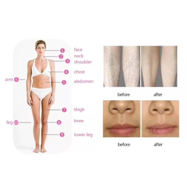 40000 Capacitor SHR Hair Removal Machine Permanent With 5 Filters