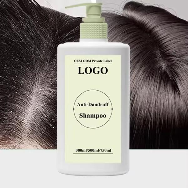 Controlo de óleo Shampoo anti caspa Anti-coceira Shampoo de limpeza profunda Shampoo capilar