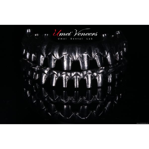 Biocompatible Titanium Marlow Bridge