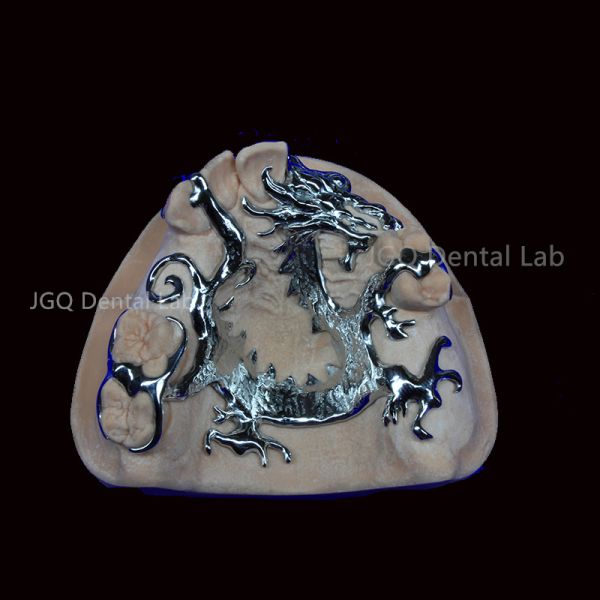 3D Printing Titanium Dental Framework for Customized Removable Dentures