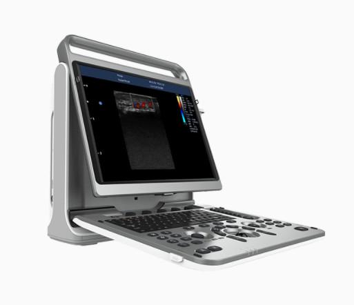 Portable Cardiac Ultrasound Machine Chison EBit 50 16.5lbs