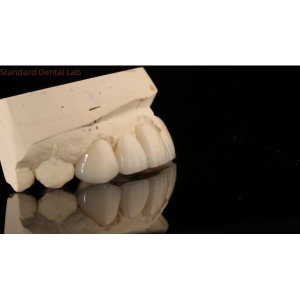 Precise Zirconia Crown Bridge Comfortable Fit / Esthetics 3-4 Days Quick Turnaround Time