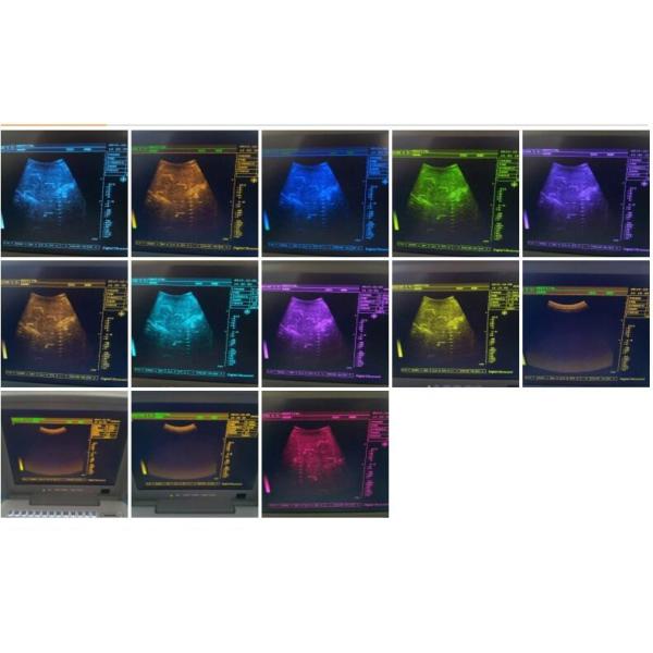 64 Body Marks Portable 2D Ultrasound Machine For Pregnancy 128 Images