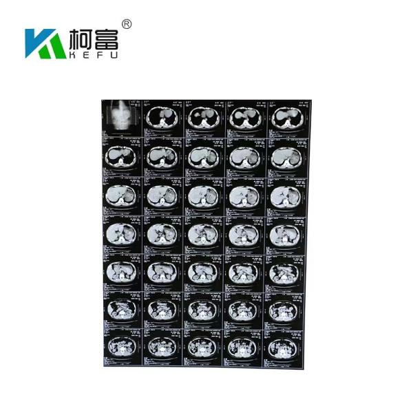 180 микронов фильма A3 струйного сухого отображая x Рэй медицинского для принтеров Epson канона