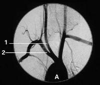 Filmes médicos de X Ray de Konida