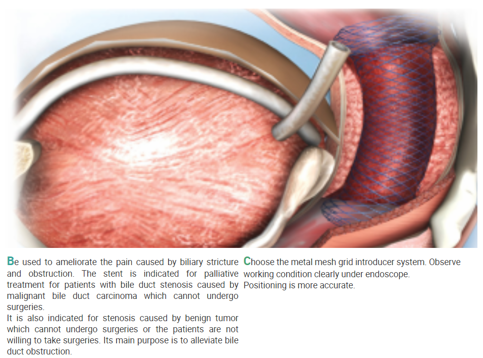 Stent тракта хирургических инструментов трубка катетера дренажа миграции Biliary анти-