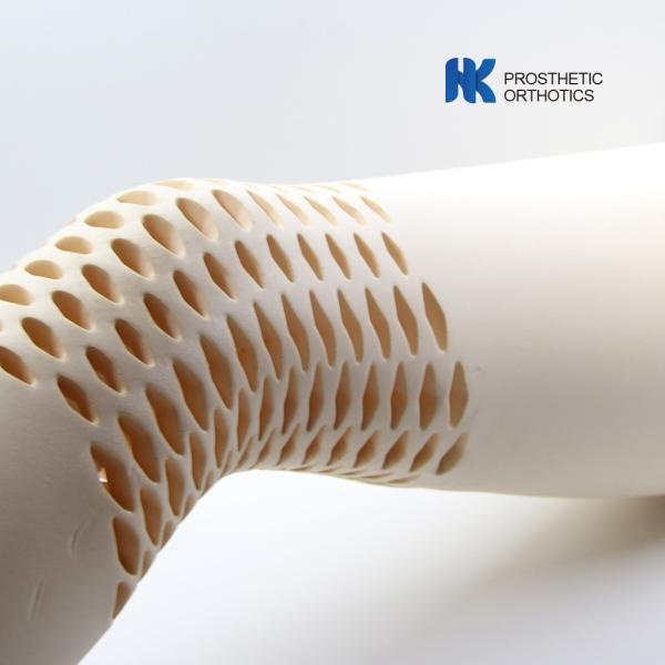 Prosthetic Pediatric Cosmetic Above Knee Using Cosmetic Cover (EVA) MESH