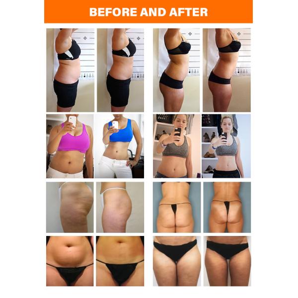 Máquina de microagujas de 300W RF 6 en 1 Máquina multifuncional para el cuidado de la piel