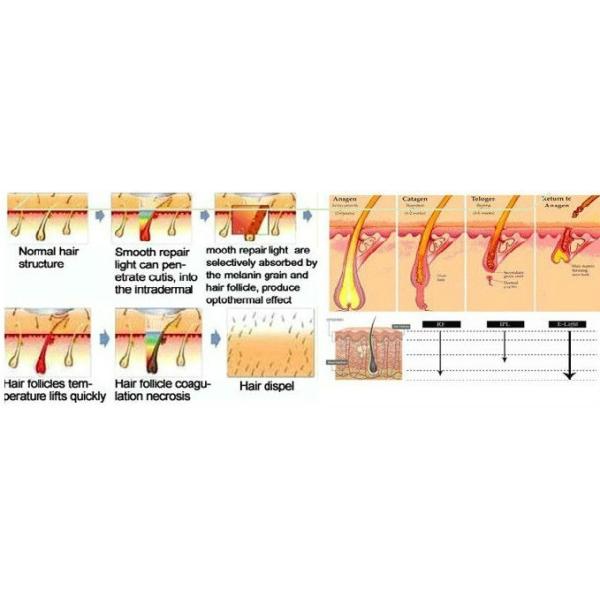 Подгонянная термическая обработка ручки полупроводника удаления волос лазера частей лазера СХР ИПЛ