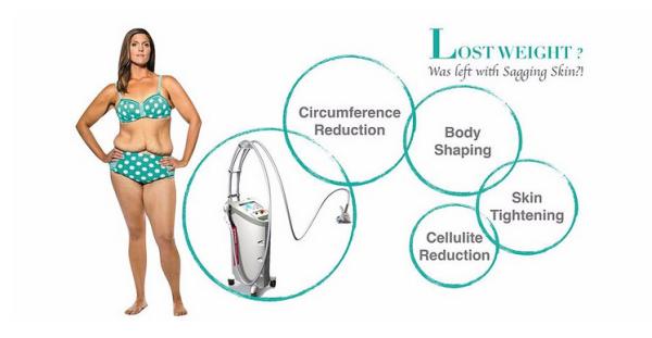 Kuma Shape RF Body Sculpting Machine With Massage Roller For Stretch Mark Removal