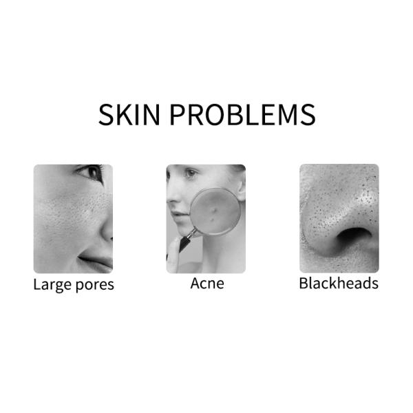 Acne Blackhead 1kg Volcanic Dead Clay Mask OEM Private Label