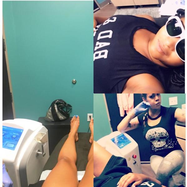 FDA CE approved Sincoheren Razorlase like lightsheer Soprano SHR hair removal laser diode laser hair remova