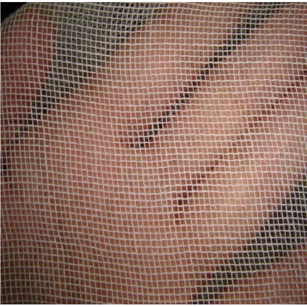 10 см x 10 см обезжиренный стерильный медицинский марлевый тампон сертифицированный медицинский уход за раной