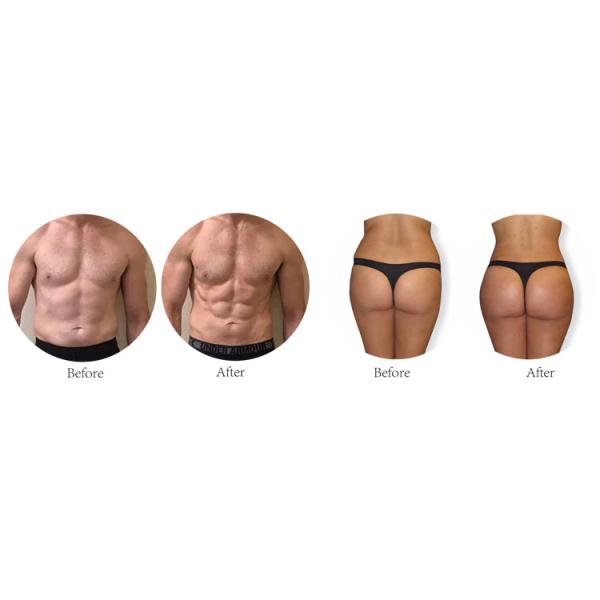 ADSS Latest Ems tesla Ems Muscle Stimulator Body Contouring Slim Beauty