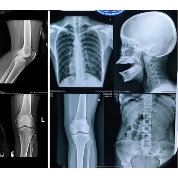 Дюйм фильма 10x12 струйного принтера канона Epson