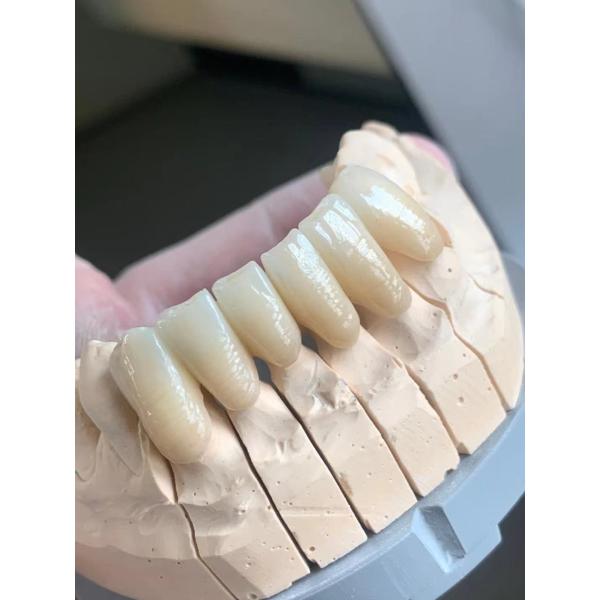 Цвет ST Pre затенял Zirconia системы CAD CAM блоков Zirconia блоки зубоврачебного зубоврачебного керамические