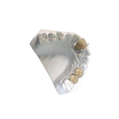 Yellow Gold Porcelain Dental Crown Lab High Strength PFM Ceramic Crown