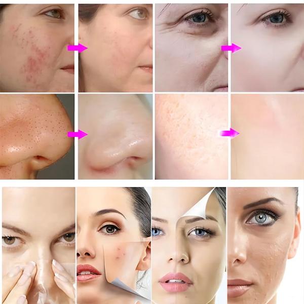 CO2 Oxygen Facial Machine with 6 Pods for Wrinkle Removal Skin Rejuvenation