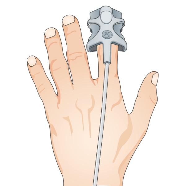 GE Datex-Ohmeda CARESCAPE ONE TruSignal SpO2 Finger Tip Sensor Reusable 9 Pin Adult 1m TS-SA-D