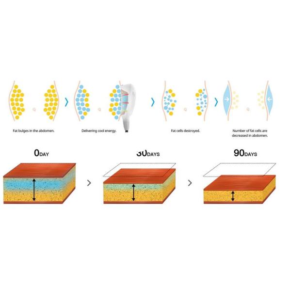 Professional Cryolipolysis Fat Freeze Slimming Machine 4 Handles Available