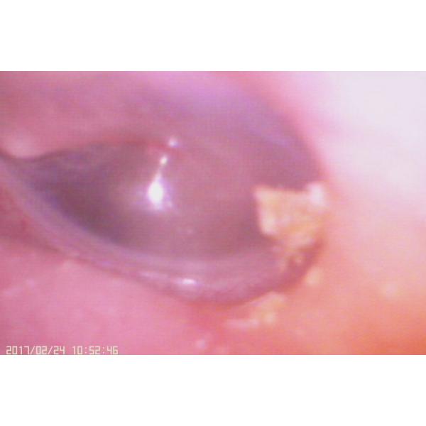 Cámara nasal de la boca de la garganta del mini Digital oído ENT video modelo opcional del alcance de WIFI con la alta resolución