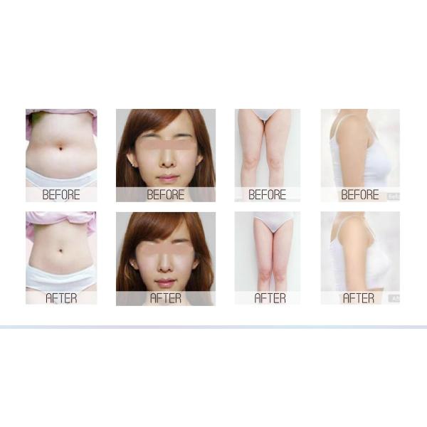 Тело формируя лазер ручек 635nm 6D RF машины 6 кавитации вакуума уменьшая прибор