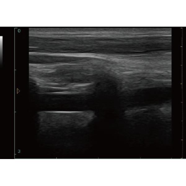 256 Frame Cine Portable Ultrasound Scanner 128 Permanent Storage With 12 Inch Screen