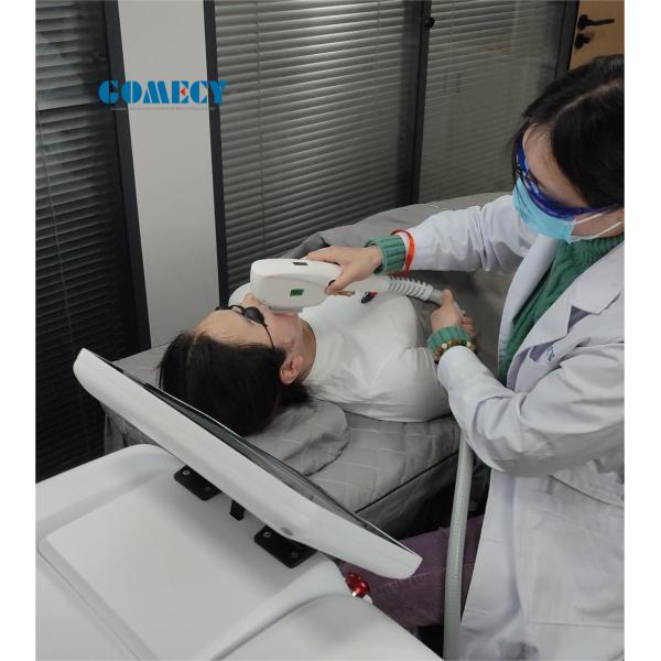Prece Pulse IPL Therapy System SH Удаление сосудов Пигмент Удаление машины для клиники