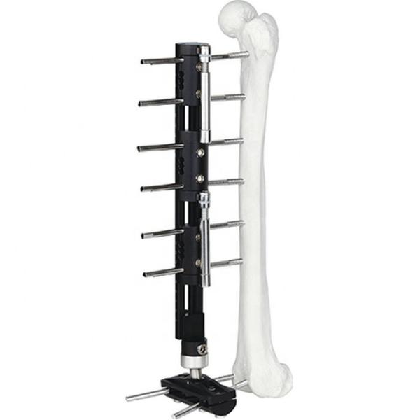 Membro pediatra do orthofix do sistema de LRS que alonga Fixator externo