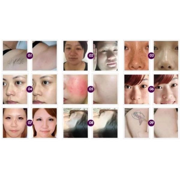 2500W RF Shr Hair Removal Machine With 10.4 Inch Touch Color Screen