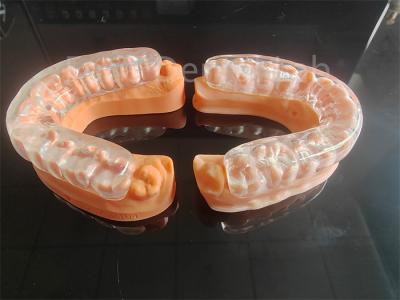Customizable Soft Dental Guard For Jaw Perfect Combination Of Comfort And Protection