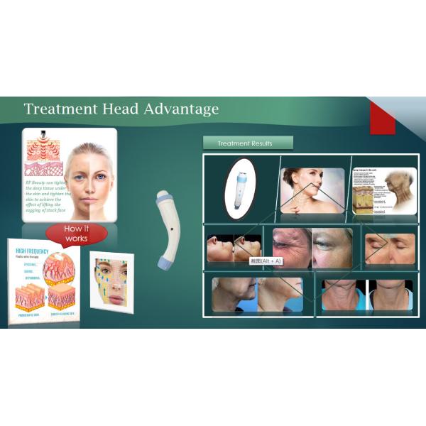 4 In 1 Ipl Yag Rf Diode Laser Machine Lasertell Hair Tattoo Removal