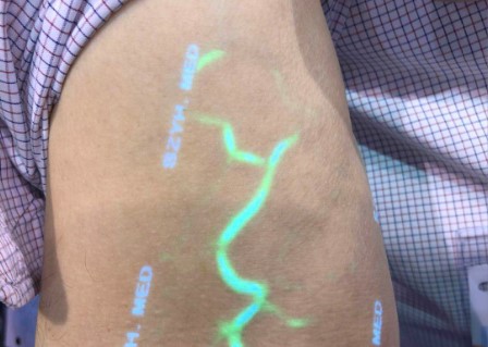 Vena de alta resolución de los pacientes obesos que localiza el infrarrojo del dispositivo para Venipuncture