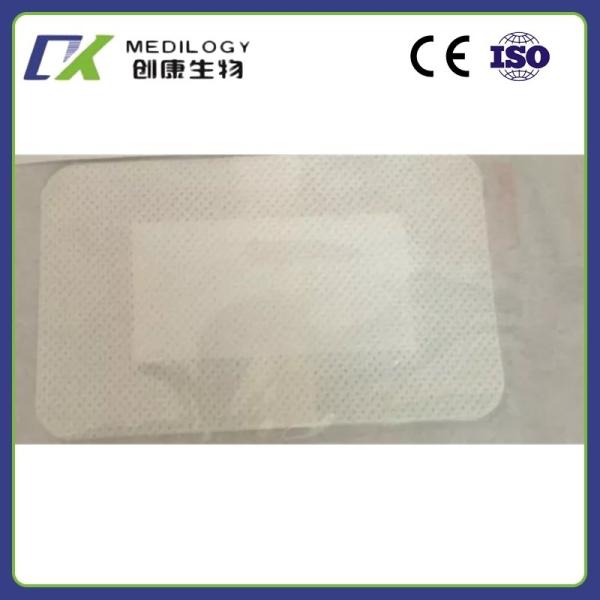 Transparent PU Wound Dressing Disposable Waterproof Self Adhesive Sterile Dressings