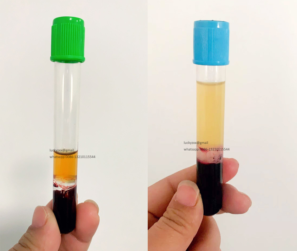 10ml 12ml Acd Gel Tube Kit for Injection Individual Blue Cap Oem Packing Pet and Glass